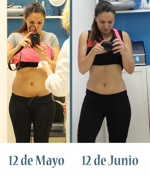 RecuperacióntraselembarazoIV_LostinVogue_EliG_19